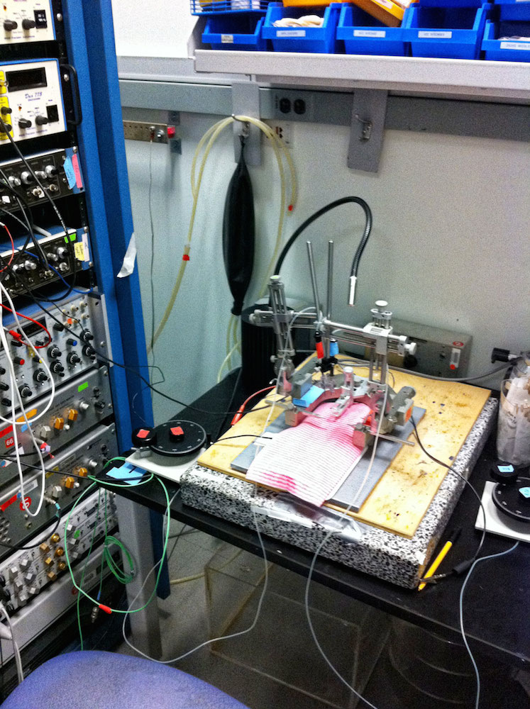 Equipment for surgical research on rats in a laboratory, including a frame for securing the animal during surgery and a rack of devices that record and process brainwave signals, is pictured.